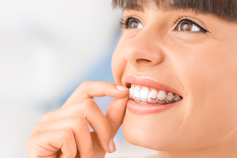 Invisalign in Shawnee